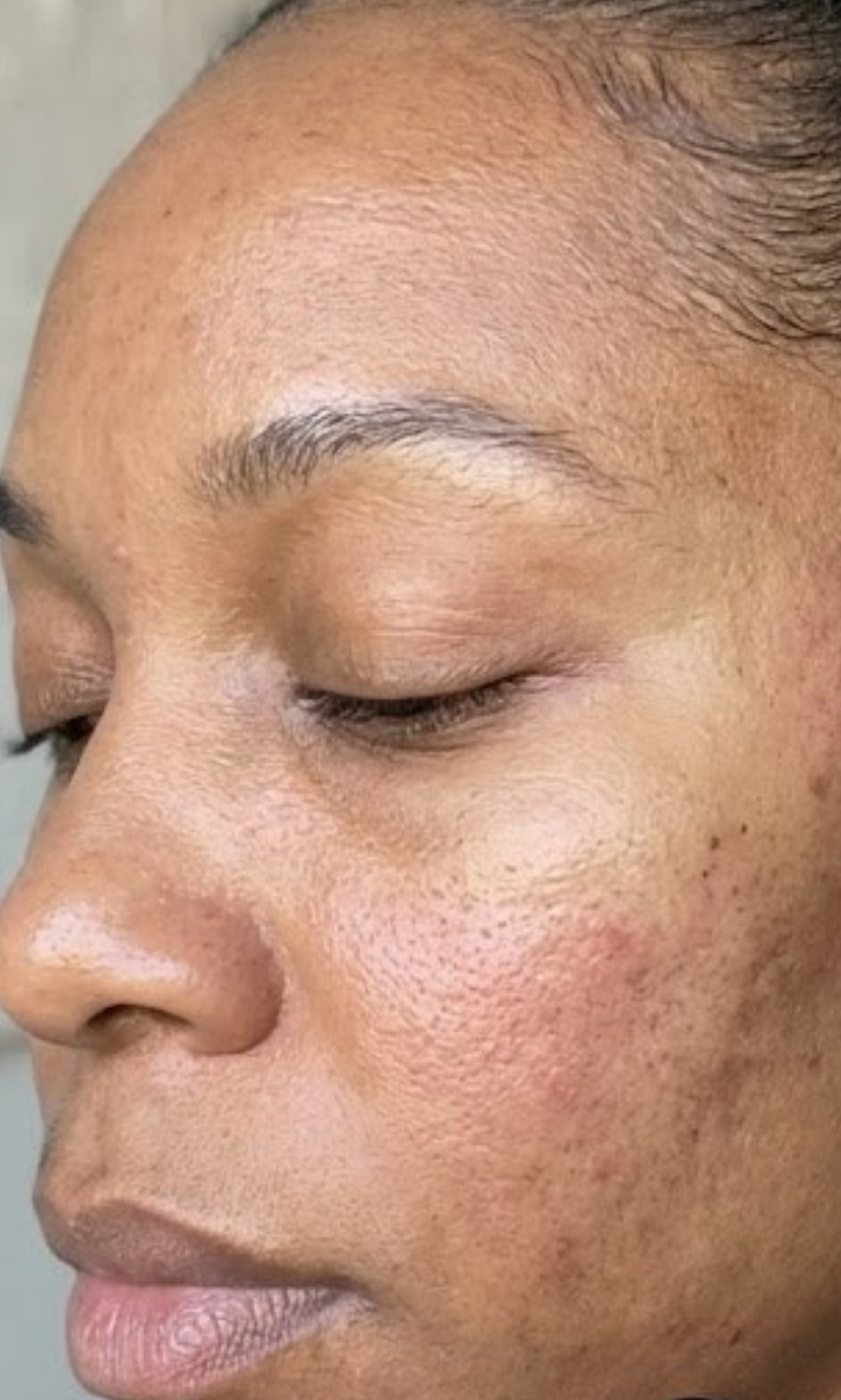 Barrier repair image