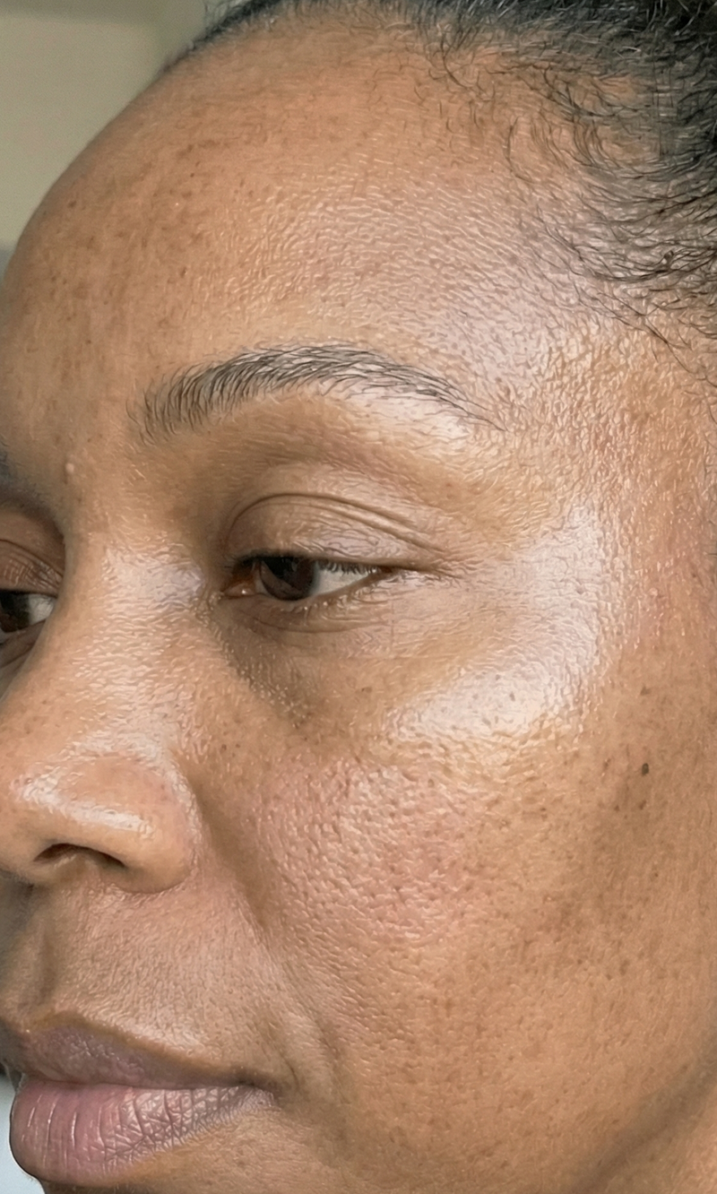 Barrier repair image