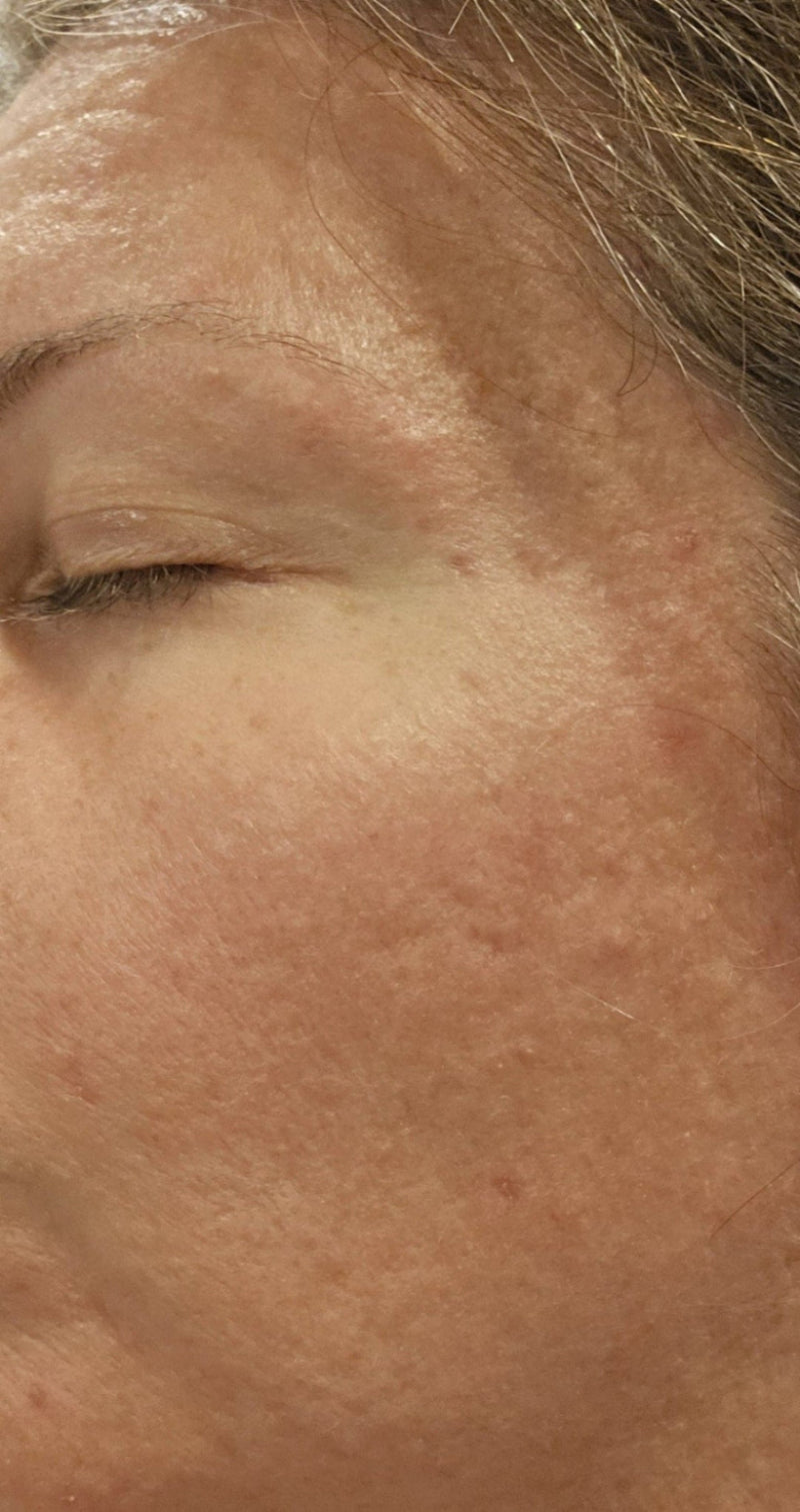 Barrier repair image