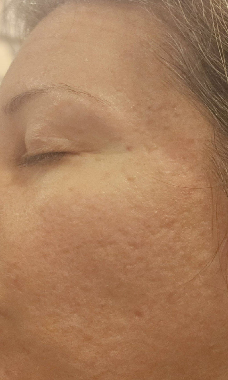 Barrier repair image